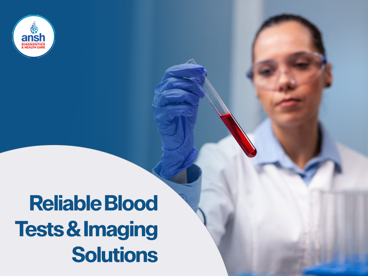 hormonal blood tests in ghaziabad: Reliable Diagnostics for Accurate Health Insights