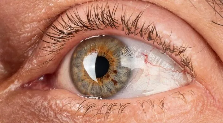 Dubai Eye Surgeon for Accurate Diagnosis and Care