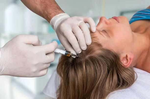 PRP Hair Treatment in Winter: Timing Tips for Peak Effectiveness