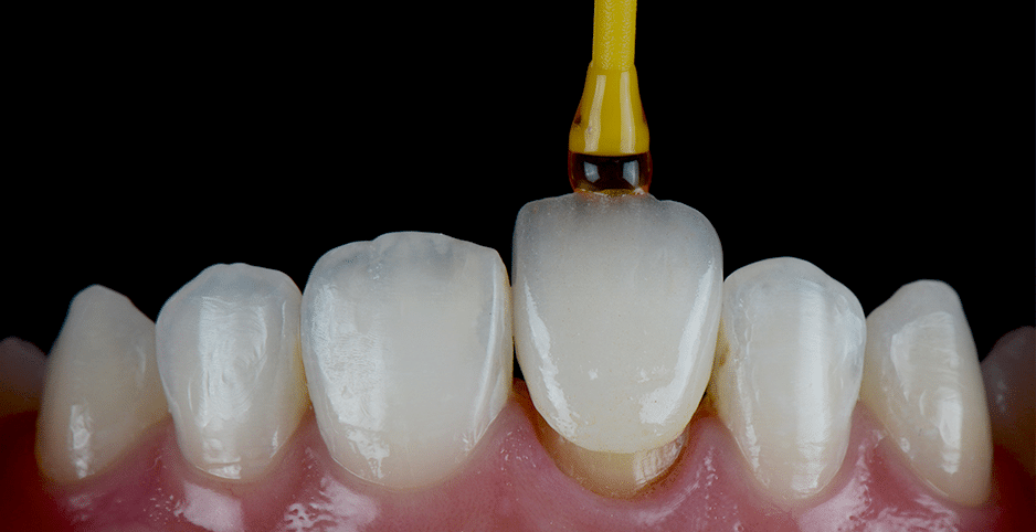 Can Prescription Drugs Cause Yellow Teeth