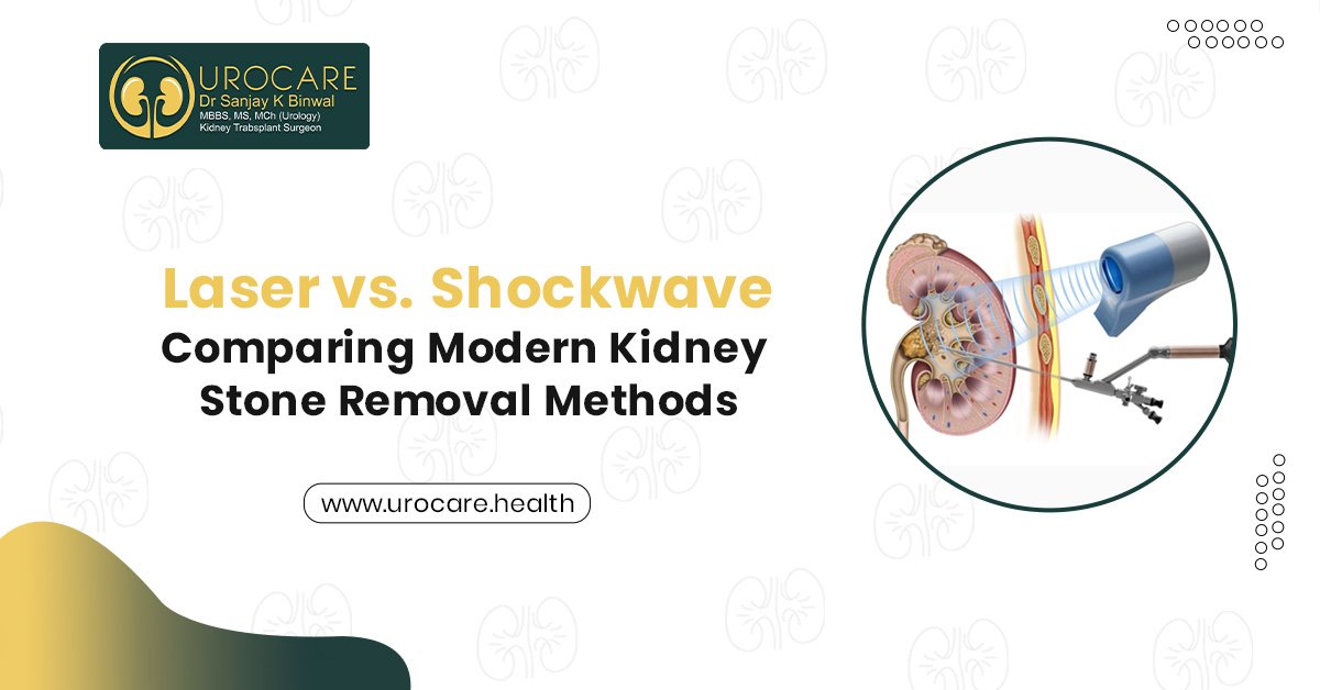 Laser vs. Shockwave: Comparing Modern Kidney Stone Removal Methods