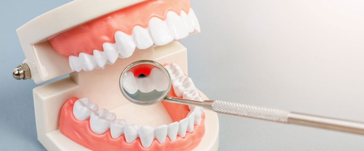 Professional Periodontal Disease Treatment in Converse, TX for Lasting Results