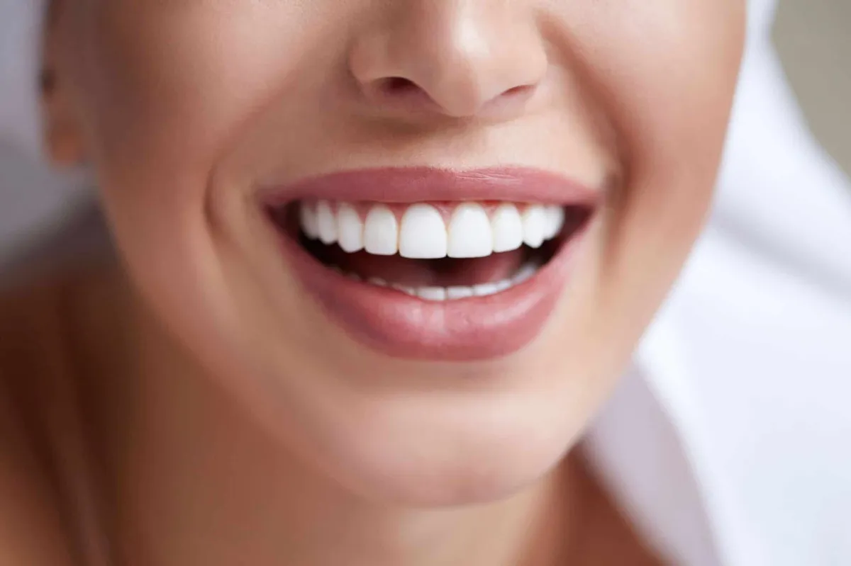 Best Teeth Whitening Dubai Options for Long-Lasting Results